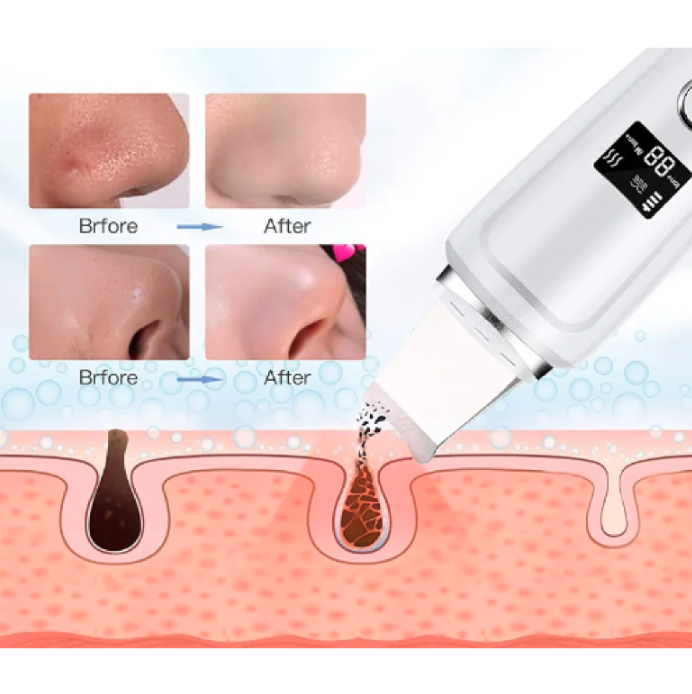 Espátula Facial Ultrasónica / Pantalla LED / Limpieza Profunda / 600 mah / 1,5W / SKIN CARE
